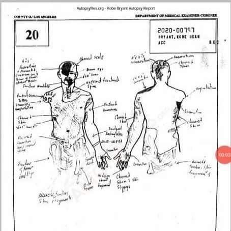 kobe and gigi autoposy|File : Kobe Bryants autopsy report, 2020.pdf